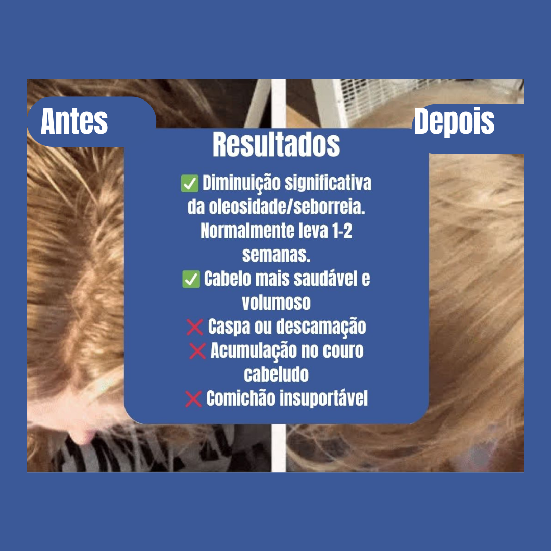 CADORNIA - Escova para cabelo sem champô